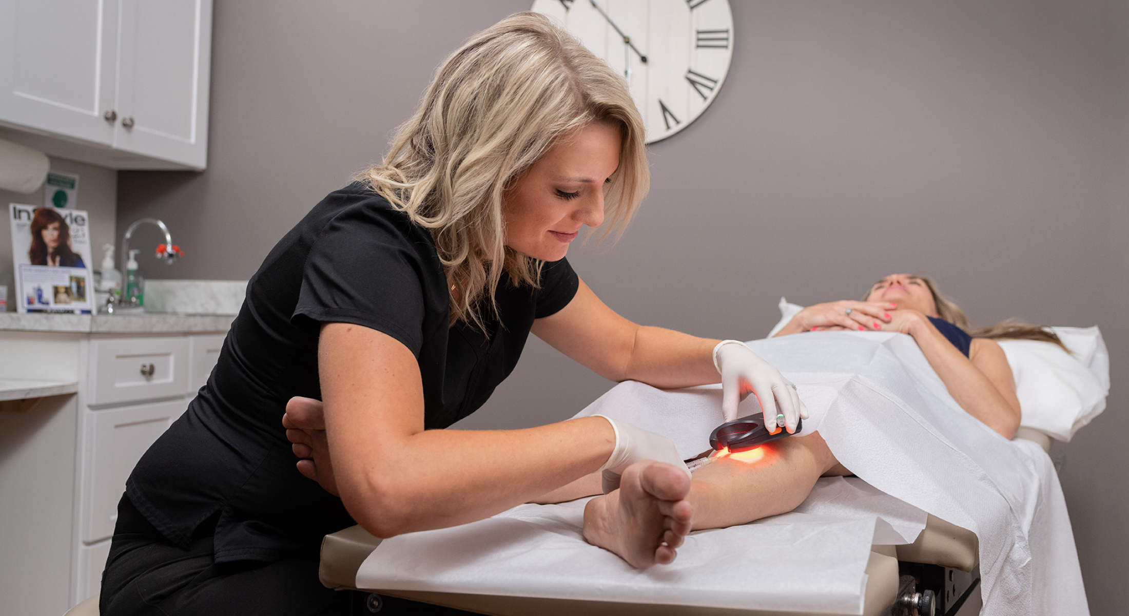 Laser vein removal for dark skin