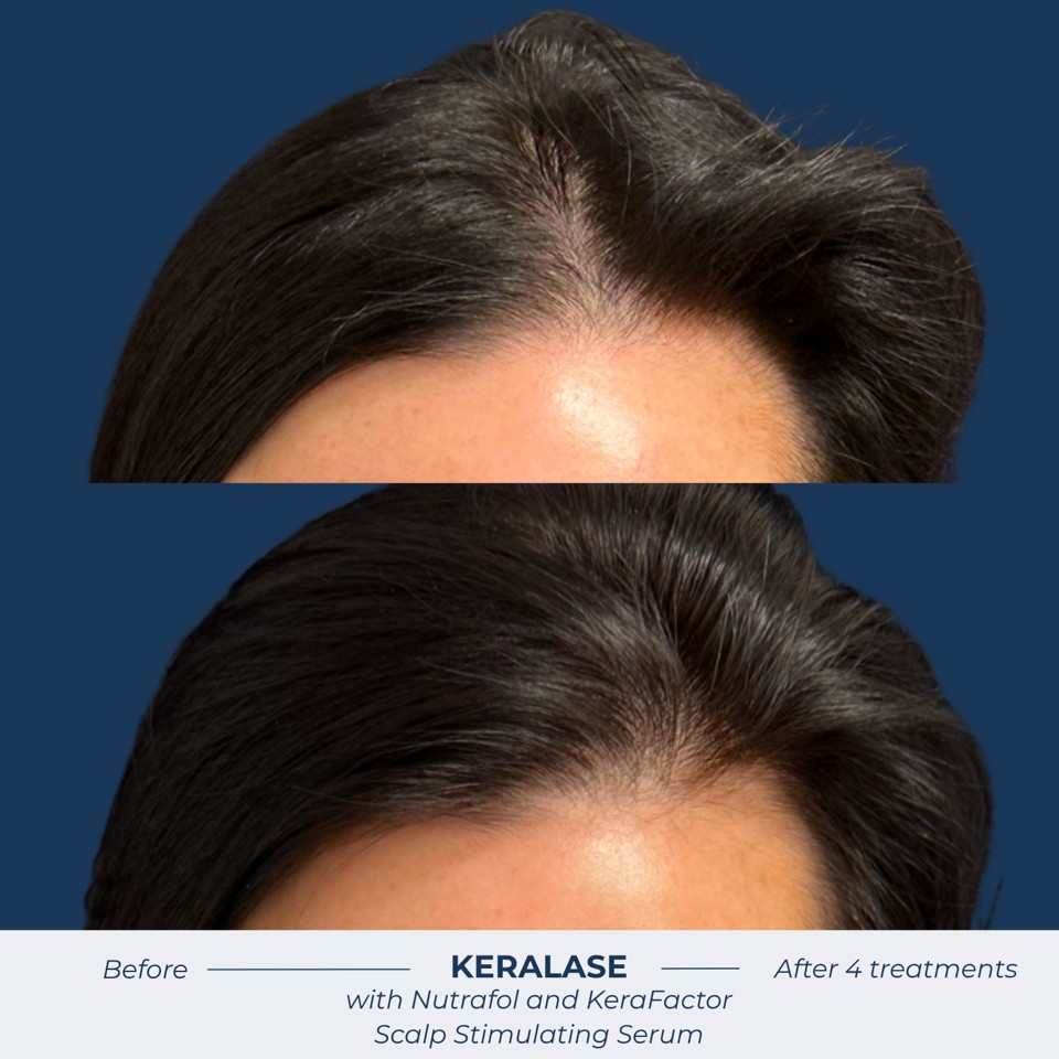 Gallery Before & After Image
