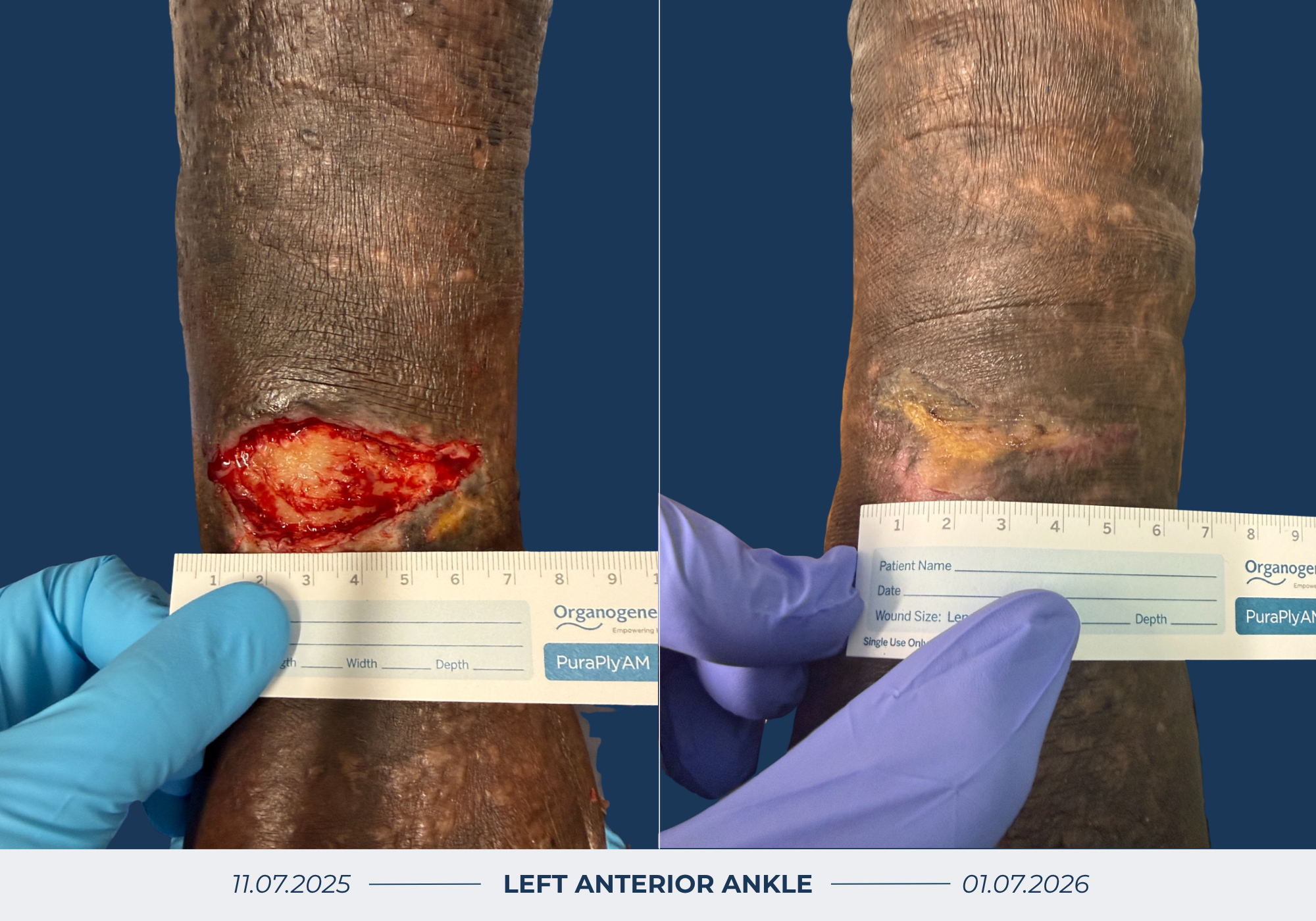 Wound Healing Before & After Image