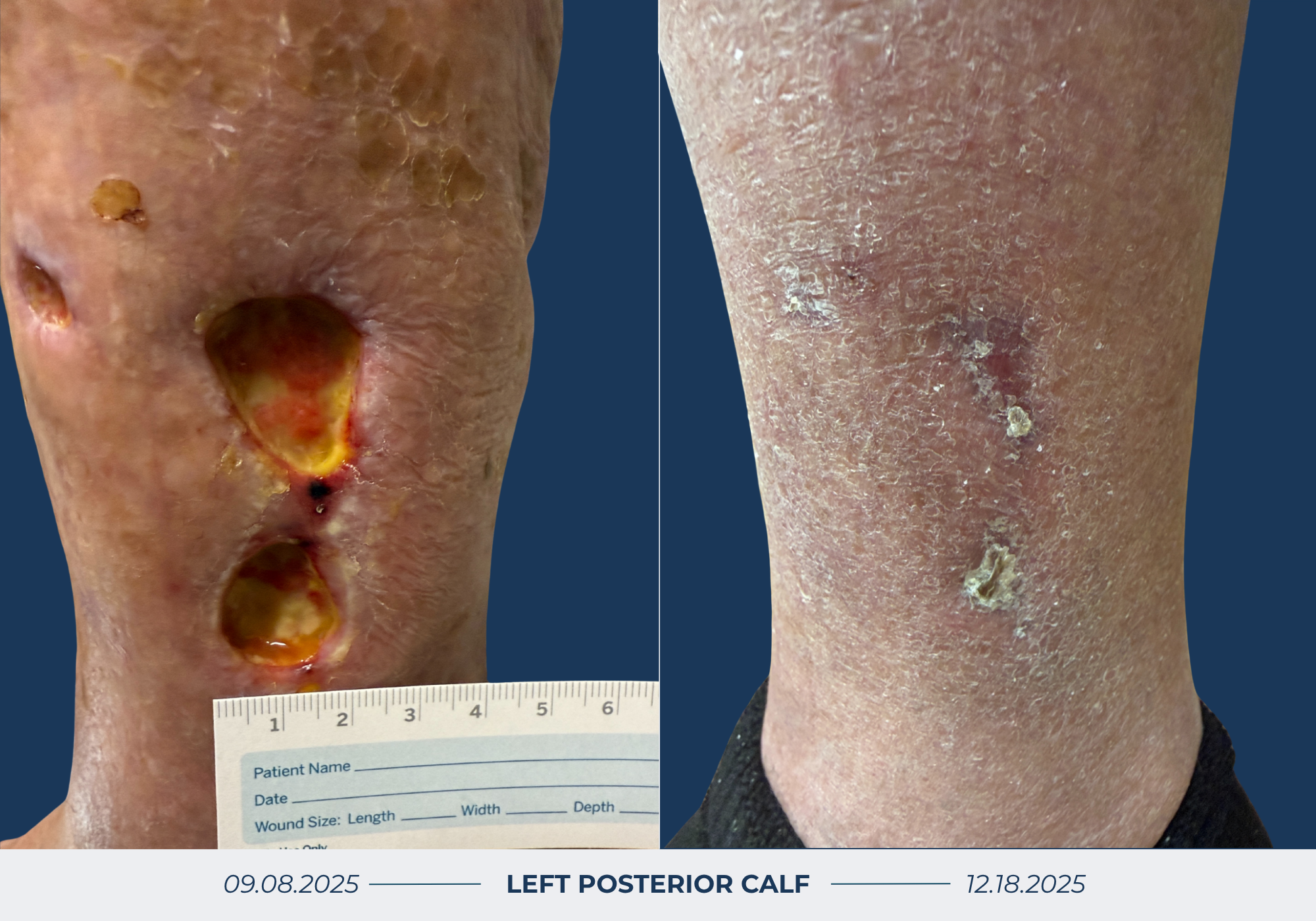 Wound Healing Before & After Image