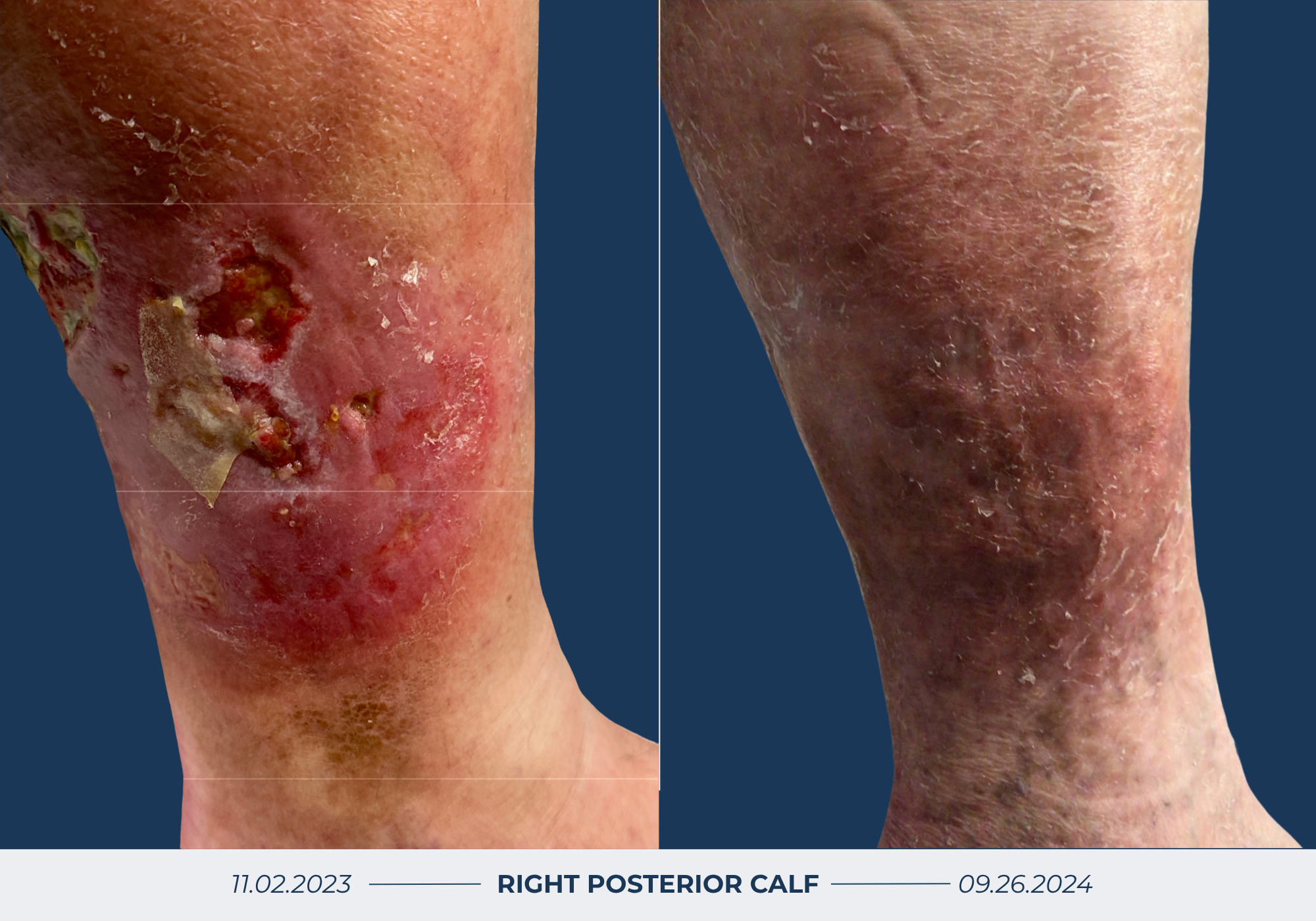 Wound Healing Before & After Image