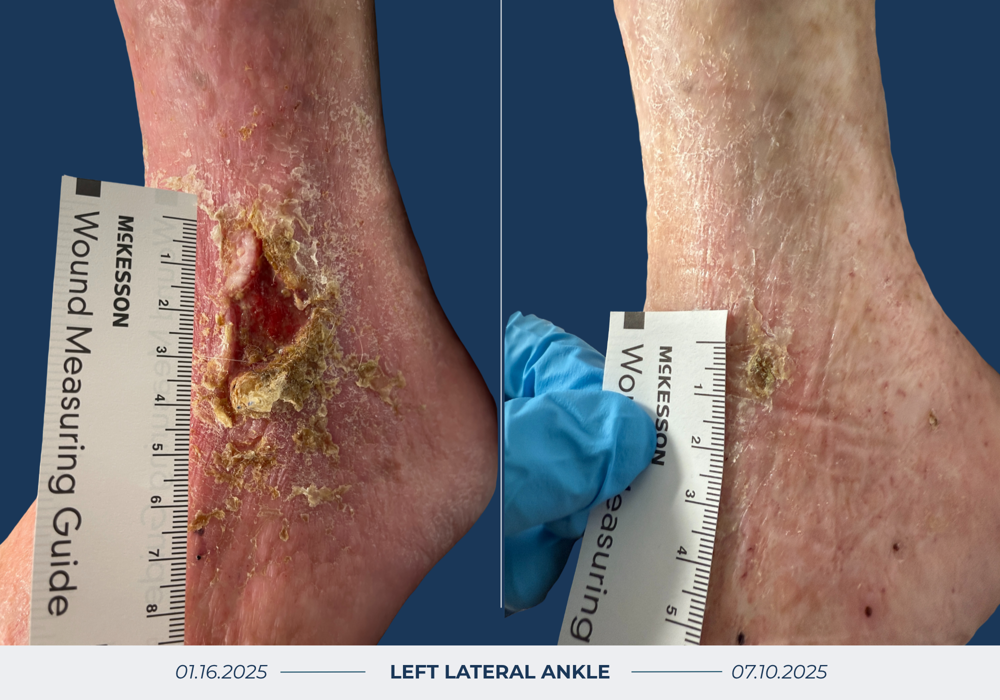 Wound Healing Before & After Image