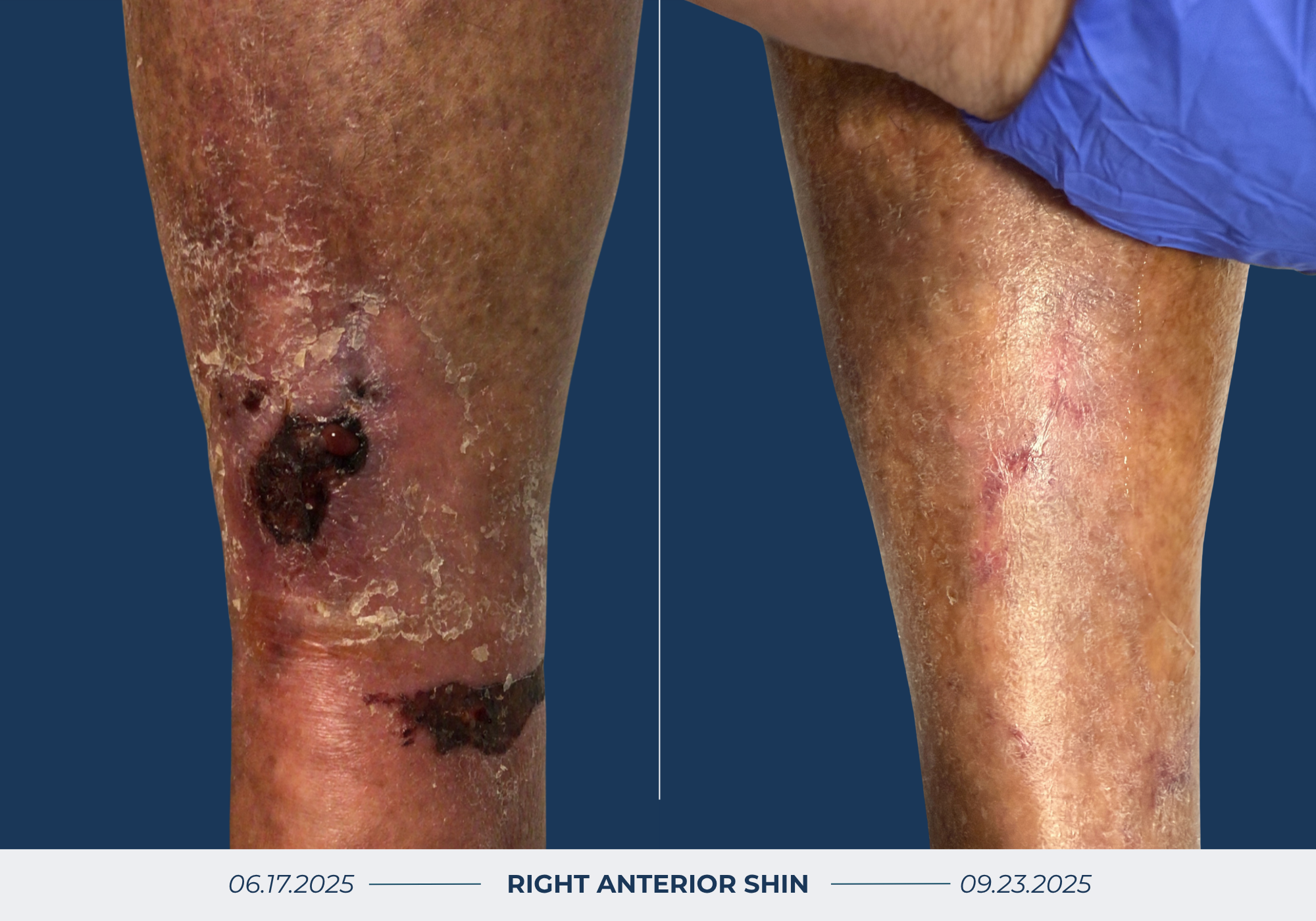 Wound Healing Before & After Image