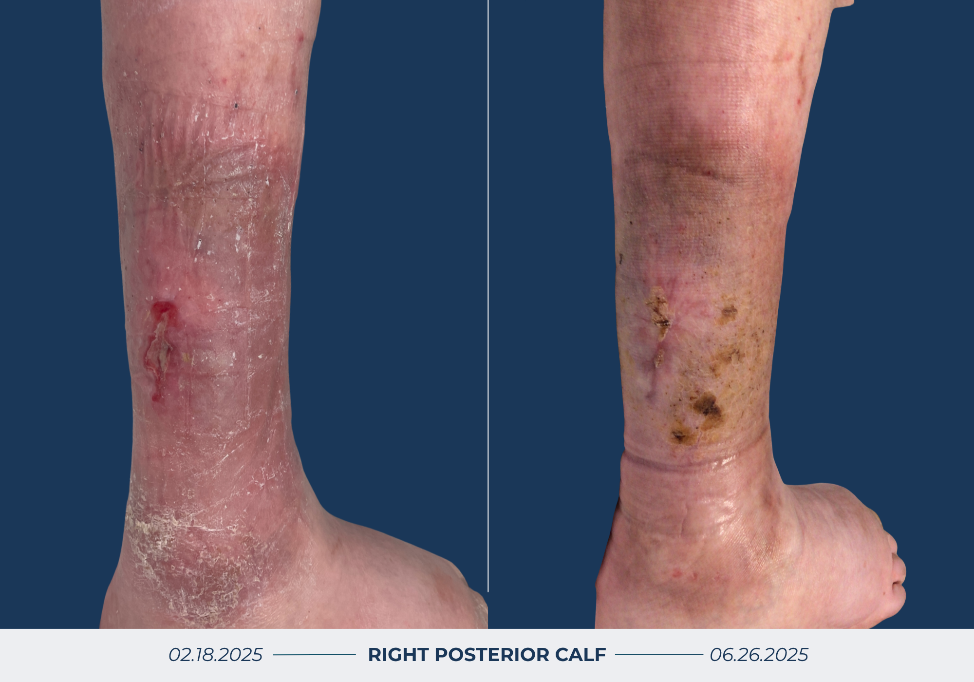 Wound Healing Before & After Image
