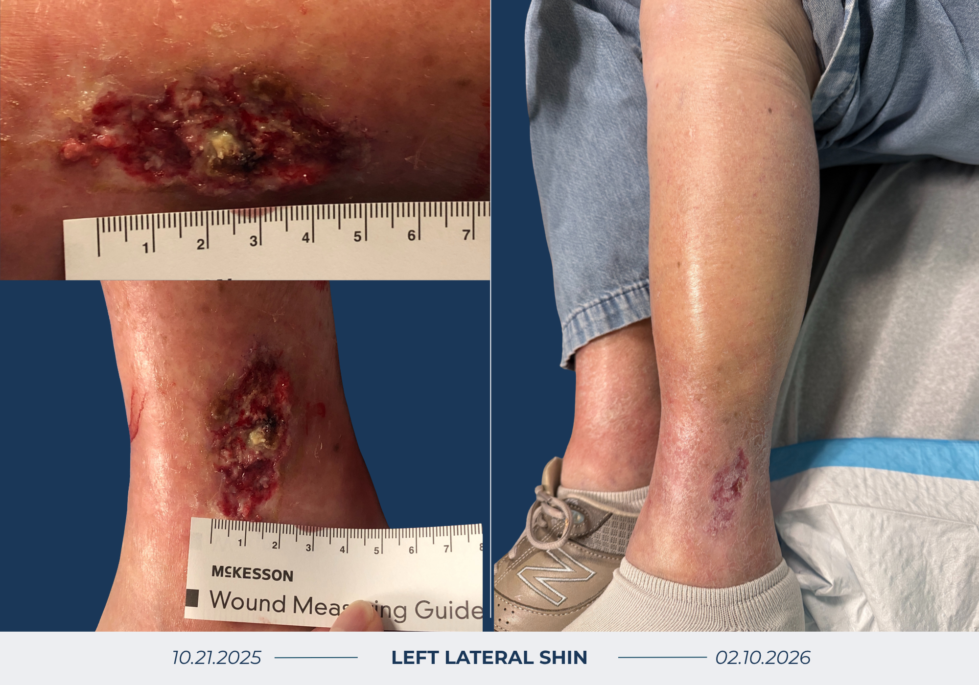 Wound Healing Before & After Image