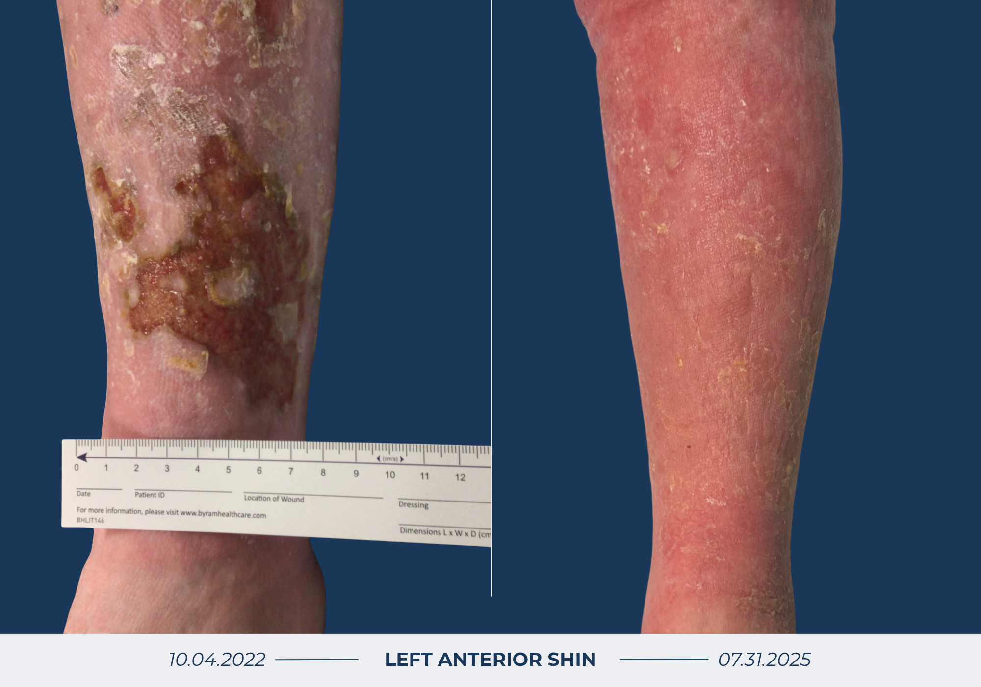 Wound Healing Before & After Image